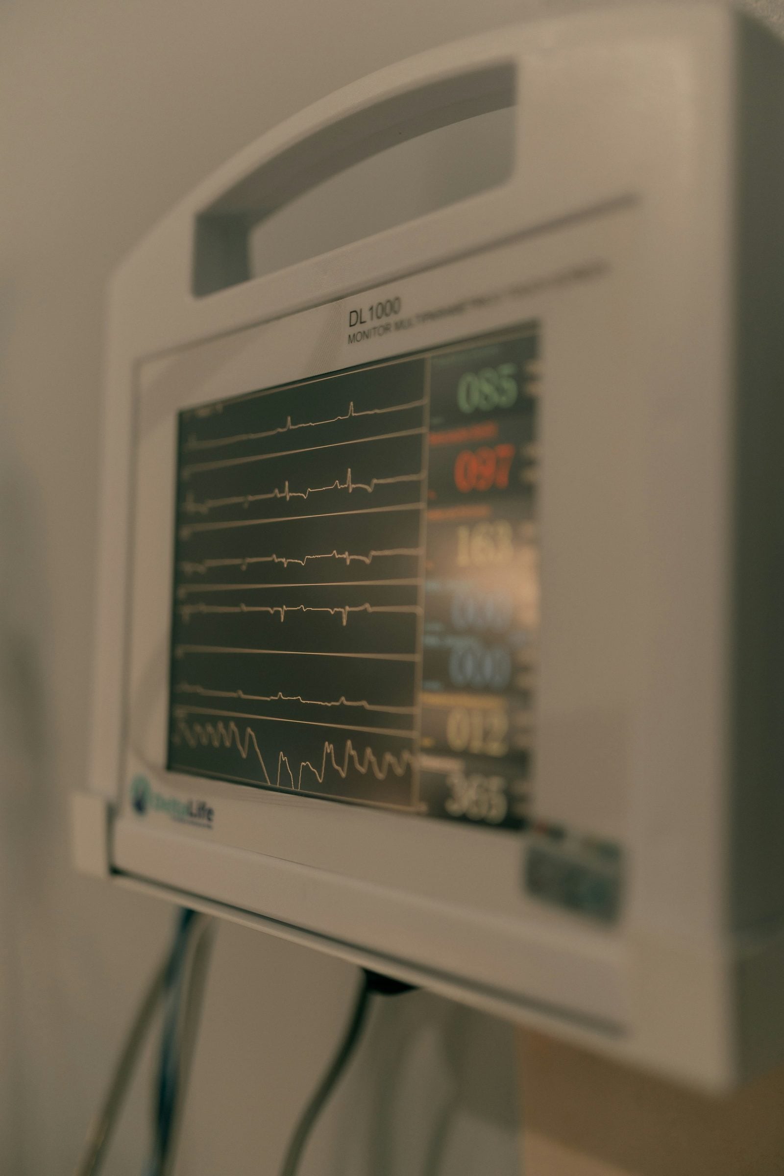 Critical-care vital-sign monitoring